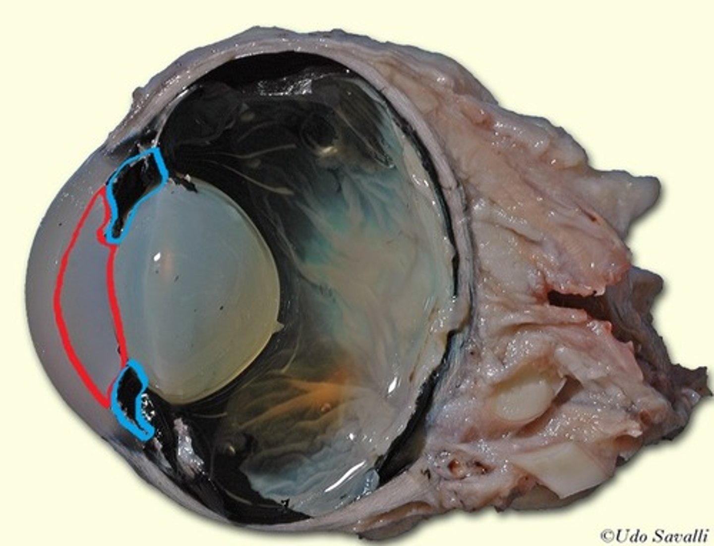 <p>lies between iris and lens &amp; has fluid with maintains intraocular pressure</p>