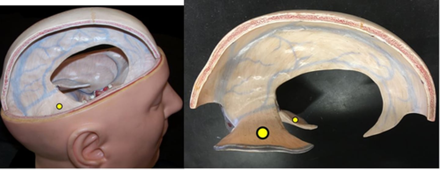 <p>separates cerebrum from cerebellum</p>