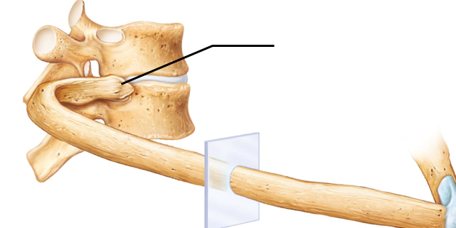 <p>What bone structure is the arrow pointing to?</p>