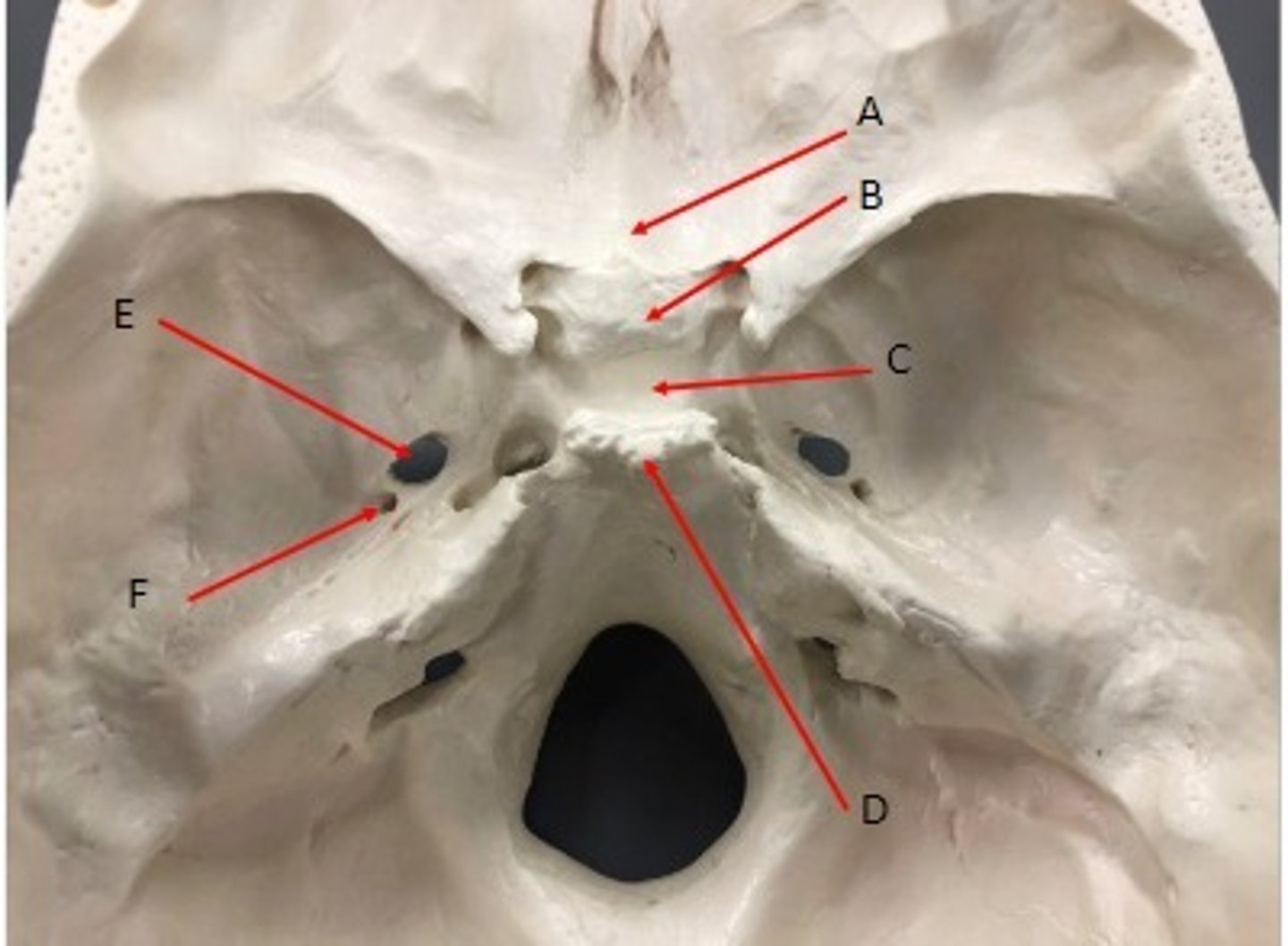 <p>What category of bone is it? What bone is it? Label the structures.</p>