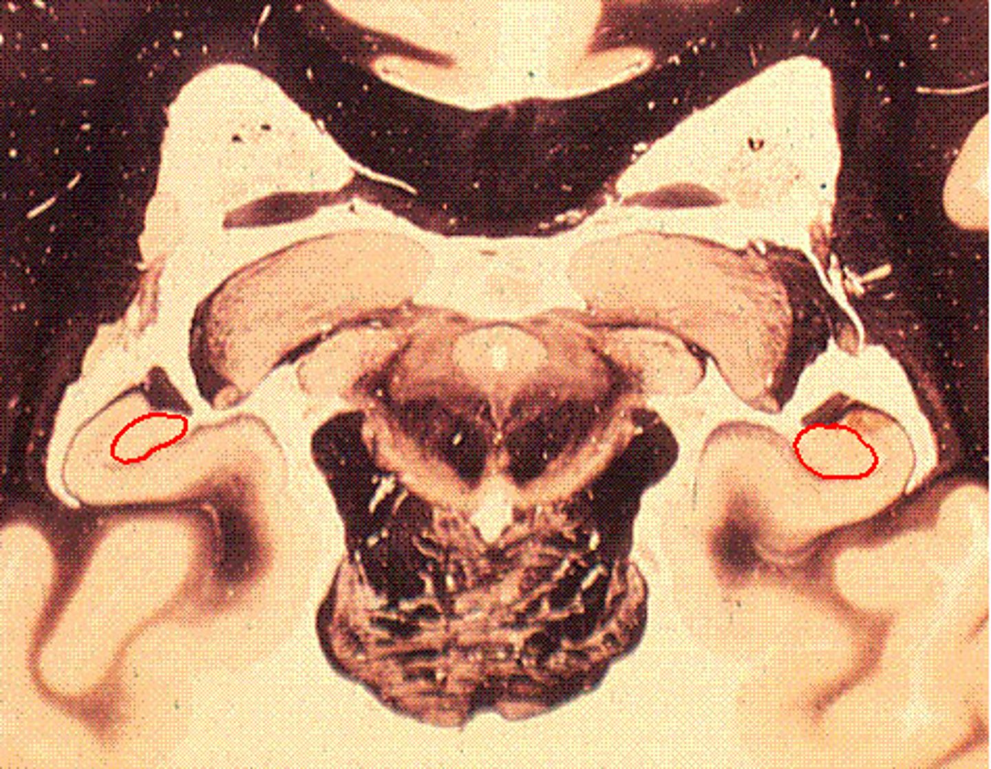 <p>first region where all sensory modalities merge together to form unique representations and memories that bind stimuli together, and thus, it plays a critical role in learning and memory</p>