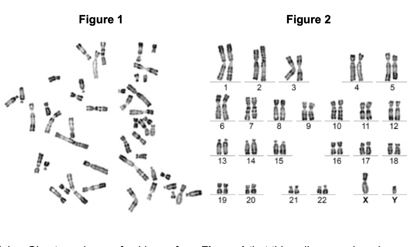 <p>Give two pieces of evidence from Figure 1 that this cell was undergoing</p><p>mitosis. Explain your answers.</p>