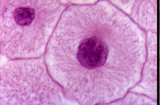 <p>What stage of the cell cycle is this?</p>