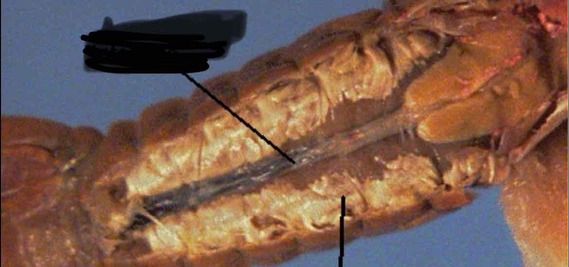 <p>Identify this structure</p>