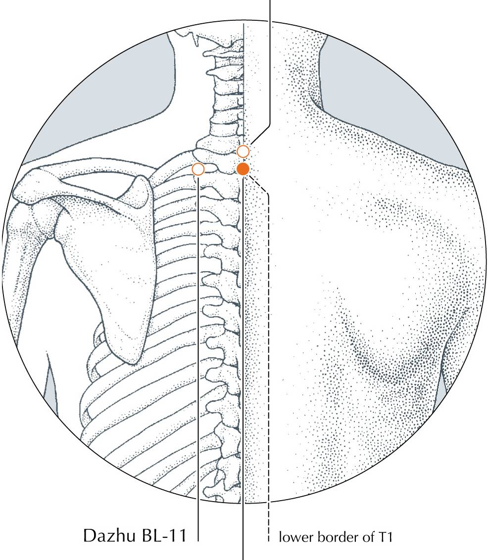 <p>DU-13</p>
