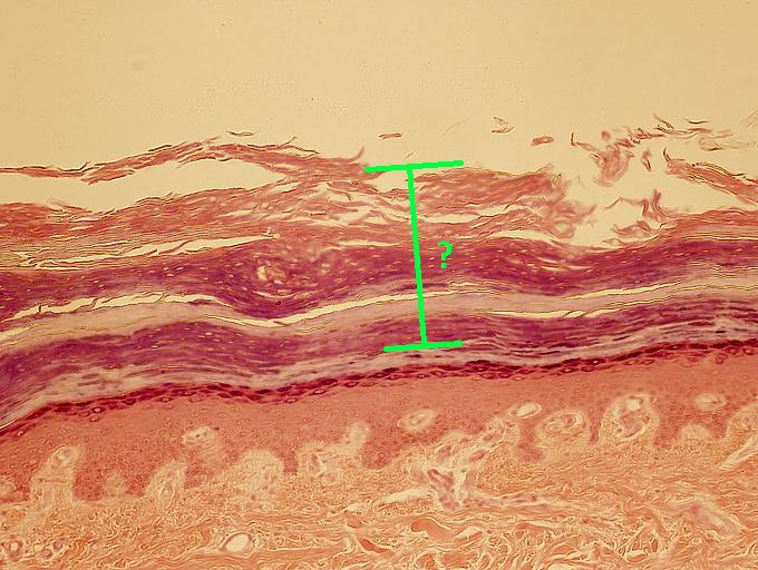 <p>Identify the indicated layer of thick skin.</p>