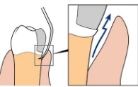 <p><span><strong> Explorer dips into trace the restoration</strong></span></p><p><span><strong> “Skating onto a section of pavement that is lower than the surrounding </strong></span><strong>pavement”</strong></p>