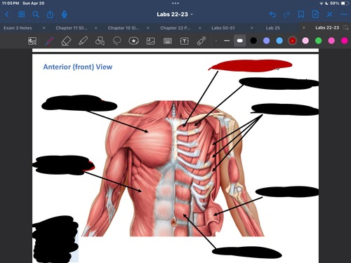 <p>What muscle is this?</p>