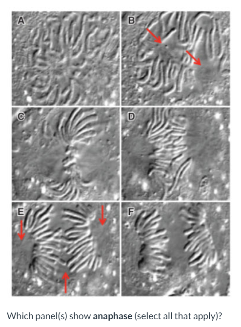 <p>Which panel(s) show&nbsp;<strong>anaphase</strong>&nbsp;(select all that apply)?</p><p><br></p>