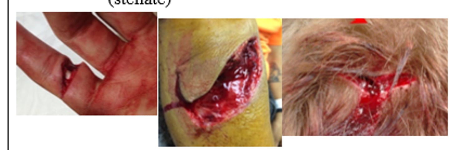 <p>- Shearing</p><p>- Tension</p><p>- Compression</p>