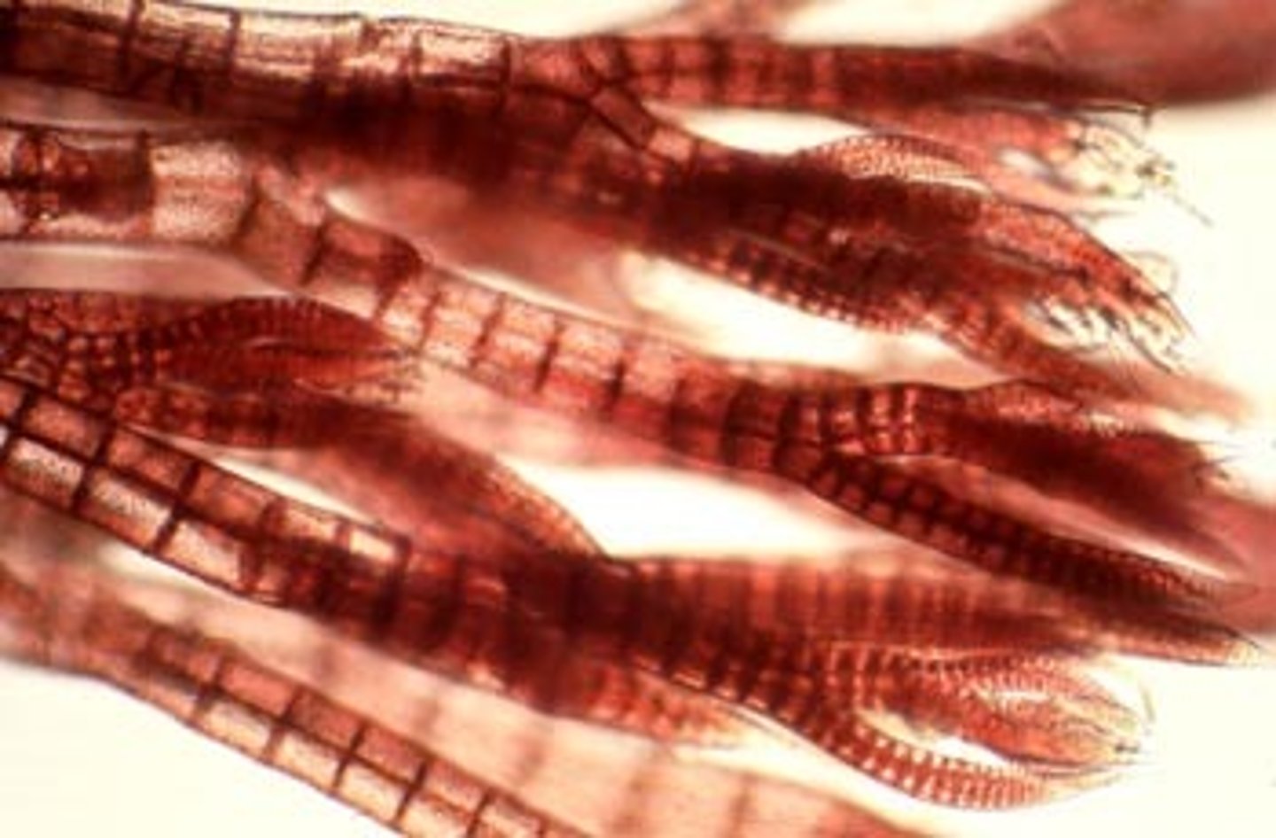 <p>rhodophytes</p>