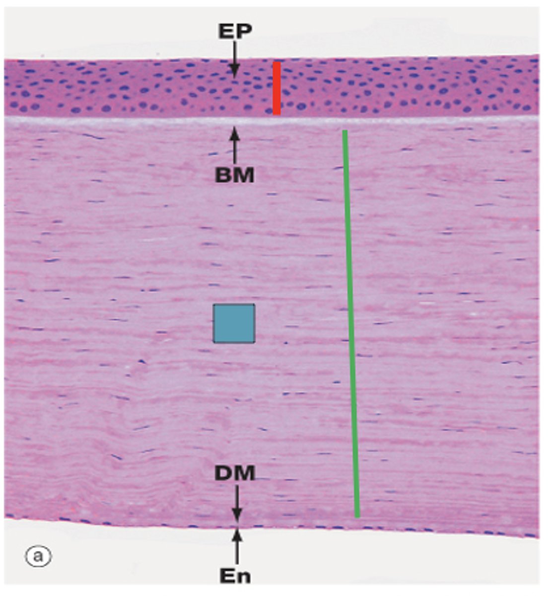 <p>Identify the layer of the cornea</p>