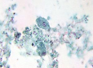 Entamoeba harmanni trophozoite
