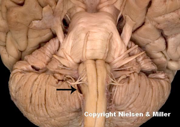 <p>what is indicated nerve</p>
