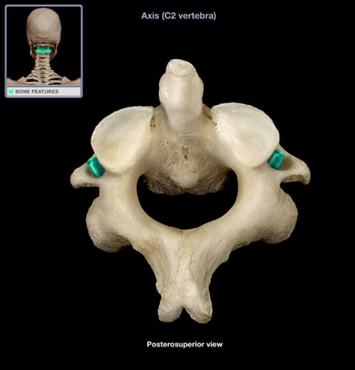 <p>(what vertebra and what structure is highlighted)</p>