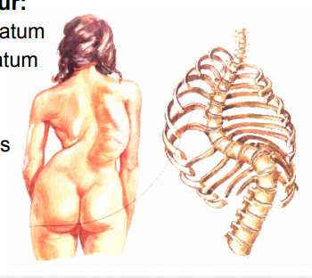 <p>Scoliosis</p>