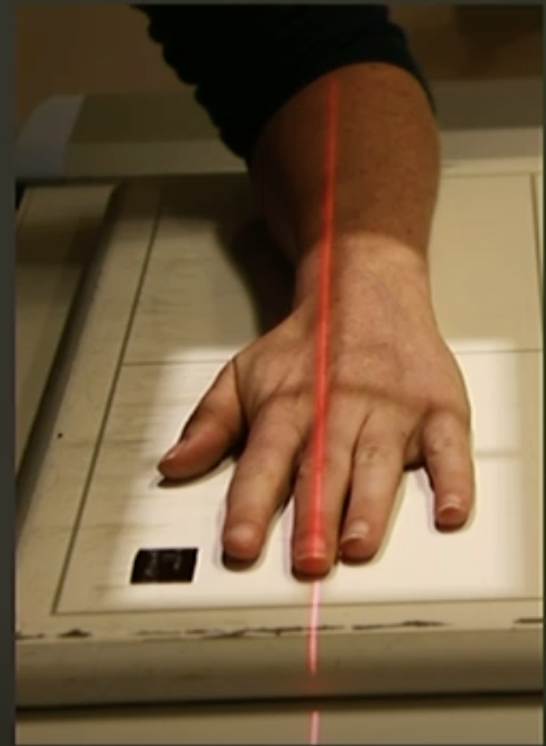 <p>Fine FS, 100cm</p><p>52kVp/2mAs</p><p>Straight tube</p><p>CR: 3rd metacarpophalangeal joint</p>