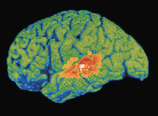 term image