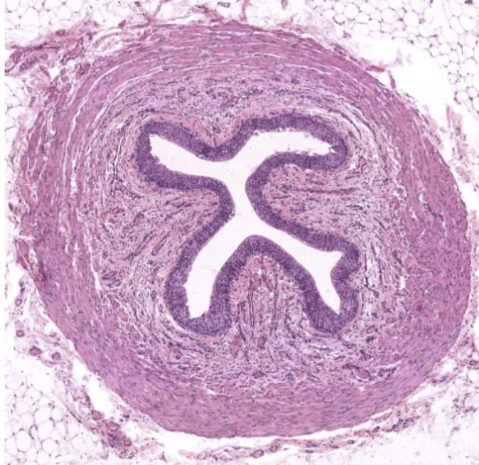 <p>histological characteristics of ureter</p>