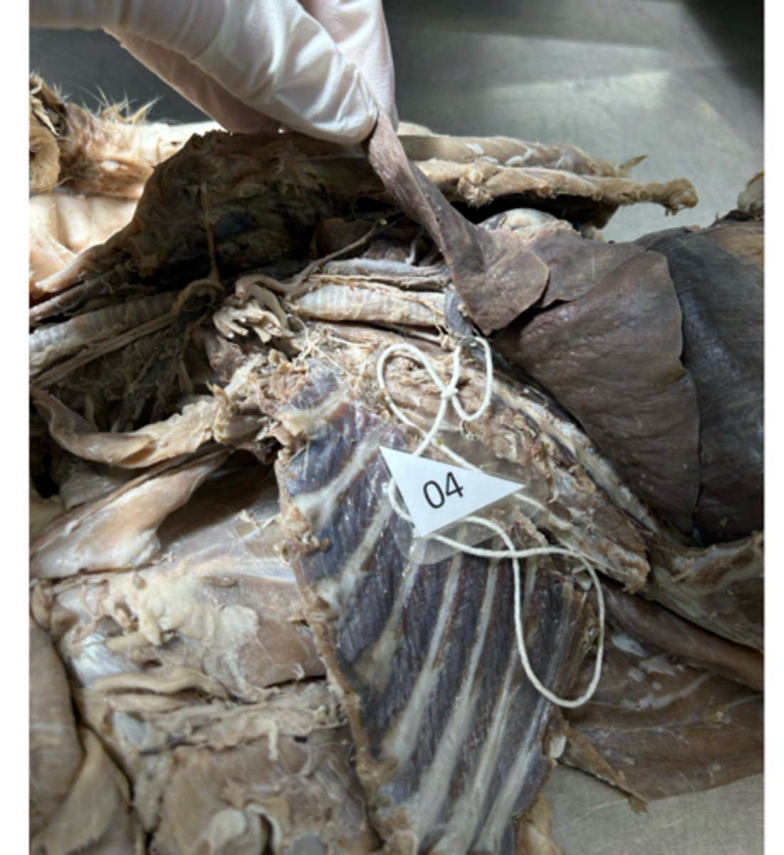 <p>The pinned vessel is a tributary of which larger vein?</p>