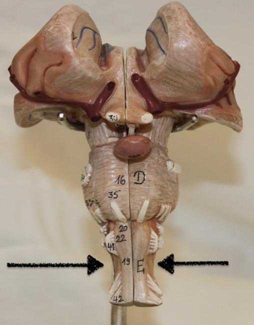 <p>identify this part of the brain</p>