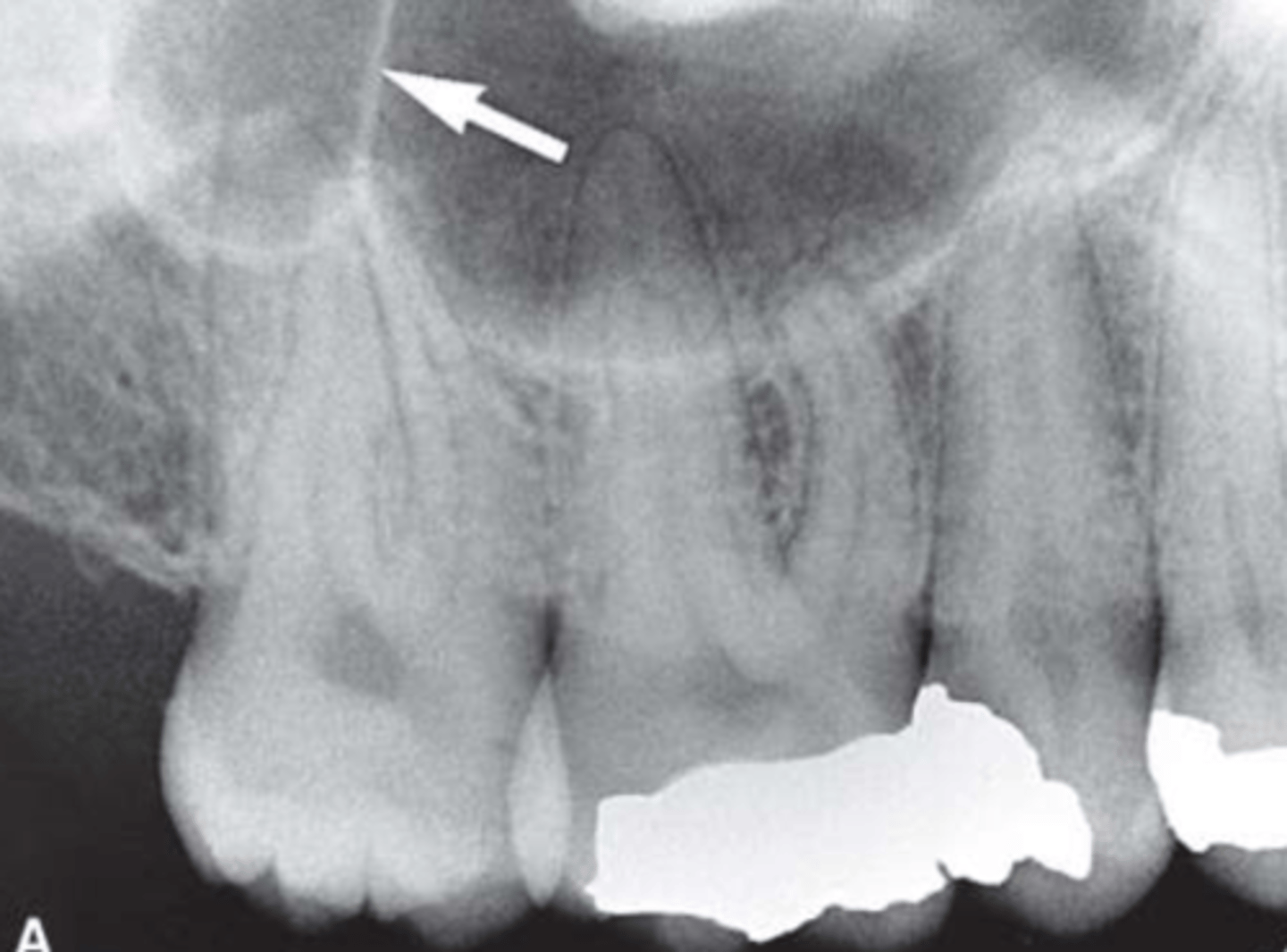 <p>Identify the structure</p>