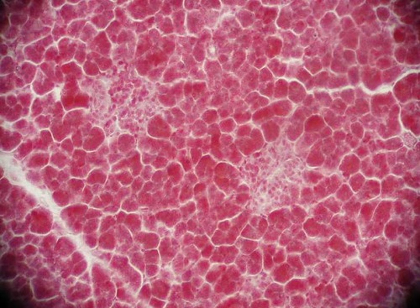 <p>The size of an object on an image after magnification</p>