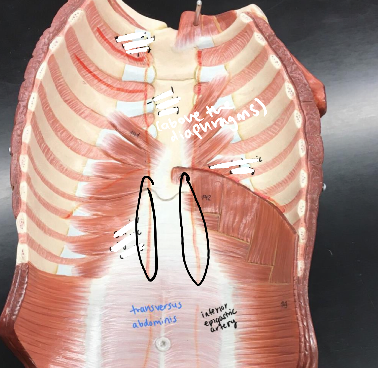 <p>The vertical red lines beneath the diaphragm and above the rectus sheath</p>