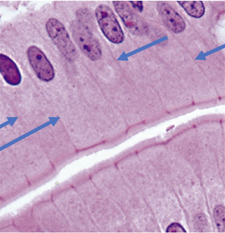 <p>What is the arrow point at?</p>