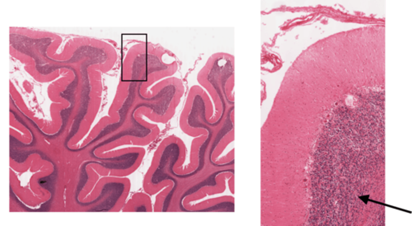 <p>Identify the layer of the cerebellum</p>