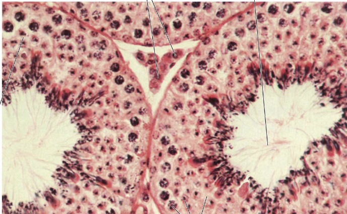 <p>What tissue is this?</p>