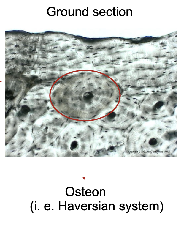 <p>osteons (Haversian system)</p>