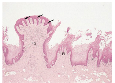 <ul><li><p>most common</p></li><li><p>fine-pointed cones giving tongue velvety texture</p></li><li><p>mechanical</p></li></ul><p></p>