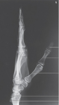 <p>What projection, position, and anatomy is this?</p>