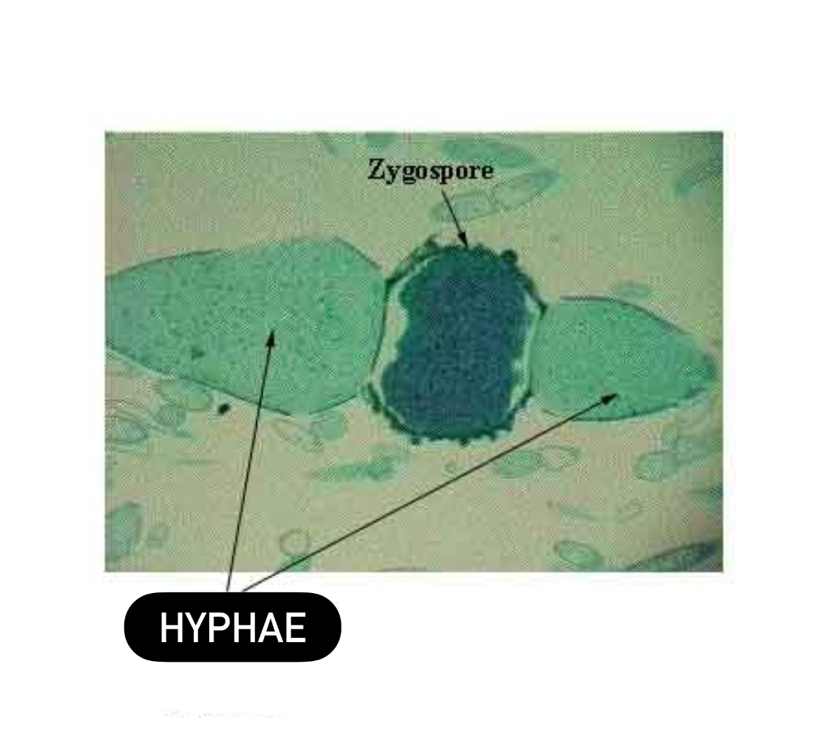 <p>Zygospore</p><p>Diploid</p><p>Domain: Eukarya</p><p>Kingdom: Fungi</p><p>Clade: Mucoromycontina</p>