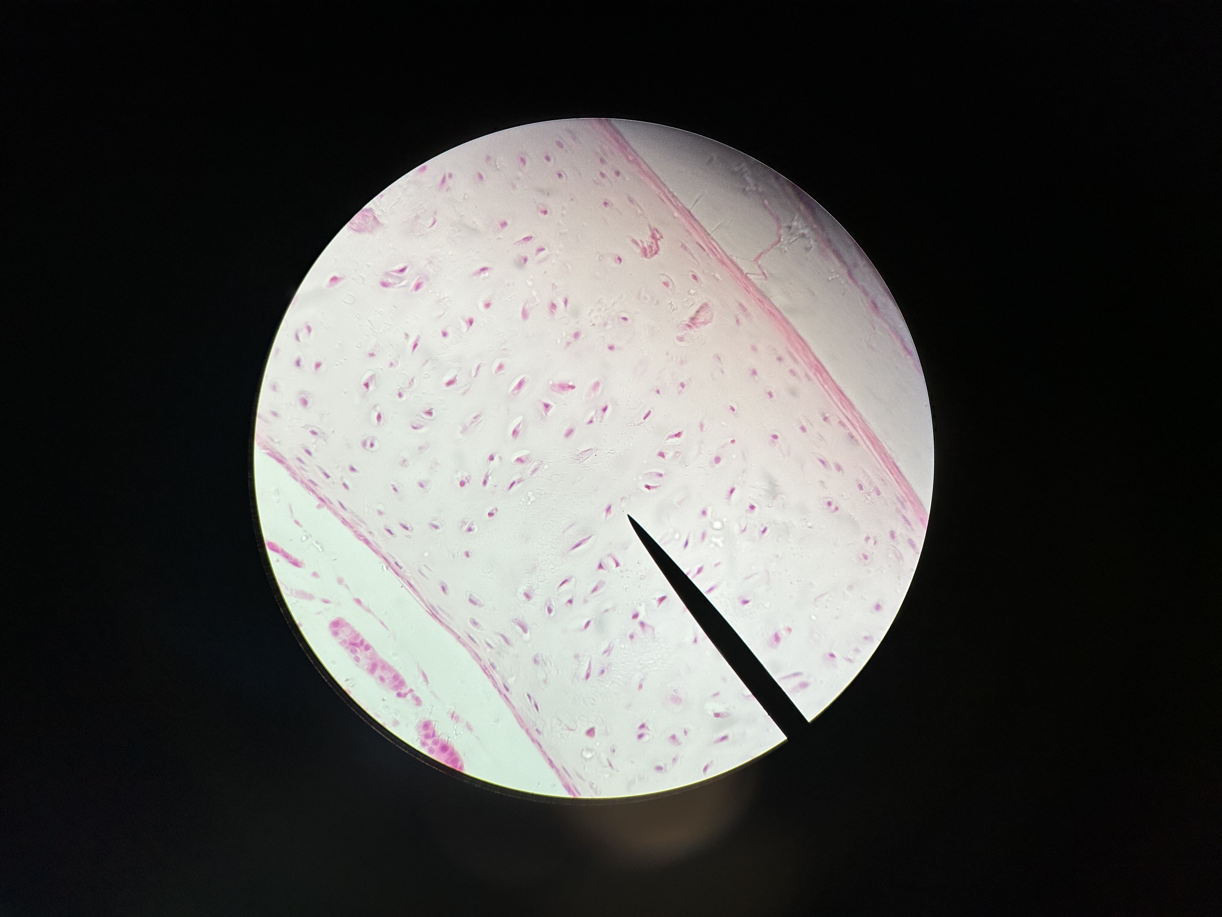 term image