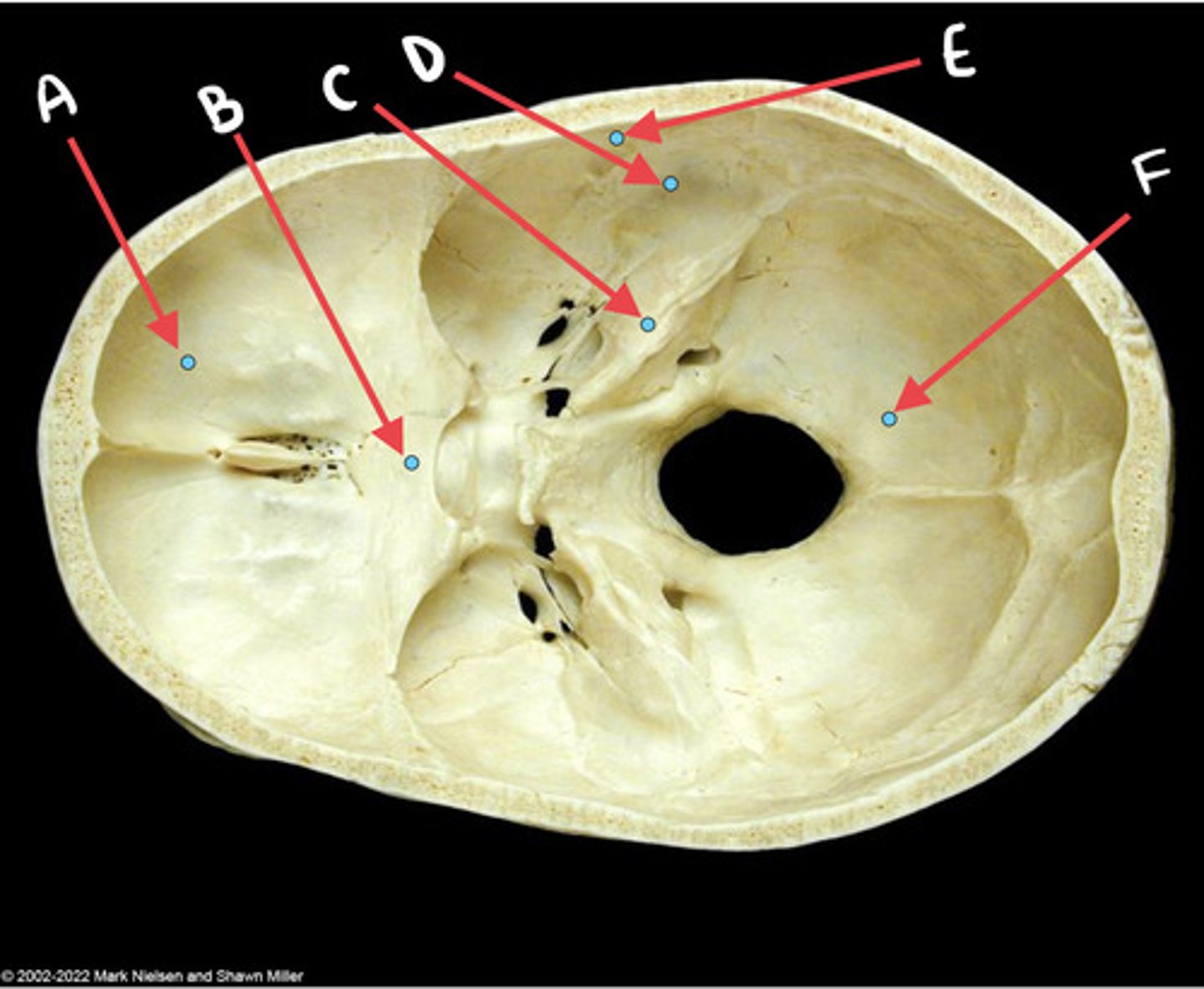 <p>C</p>