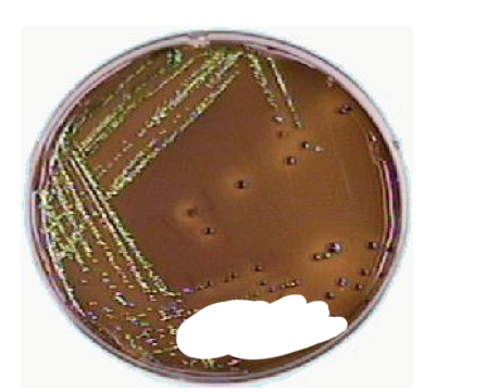 <p>Eosin Methylene Blue Agar (EMB) results</p>