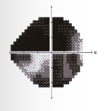 <p>What kind of defect is this</p>