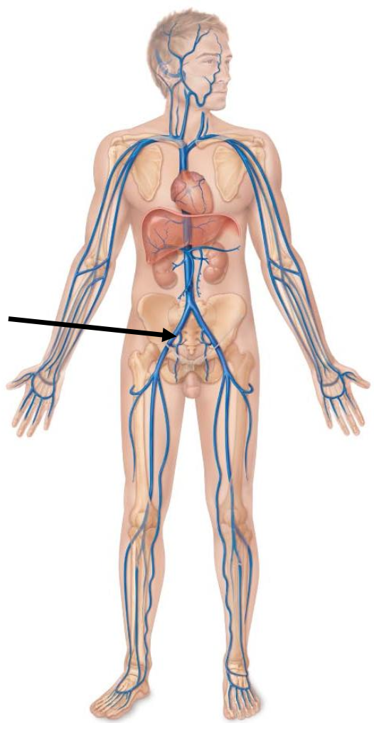 <p>The arrow is pointing to </p><p></p><p>a. Femoral vein</p><p>b. External iliac vein</p><p>c. Great saphenous vein</p><p>d. Common iliac vein</p>