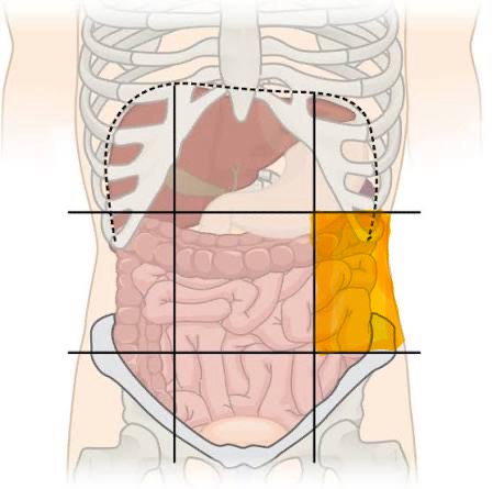 <p>Left Lumbar</p>