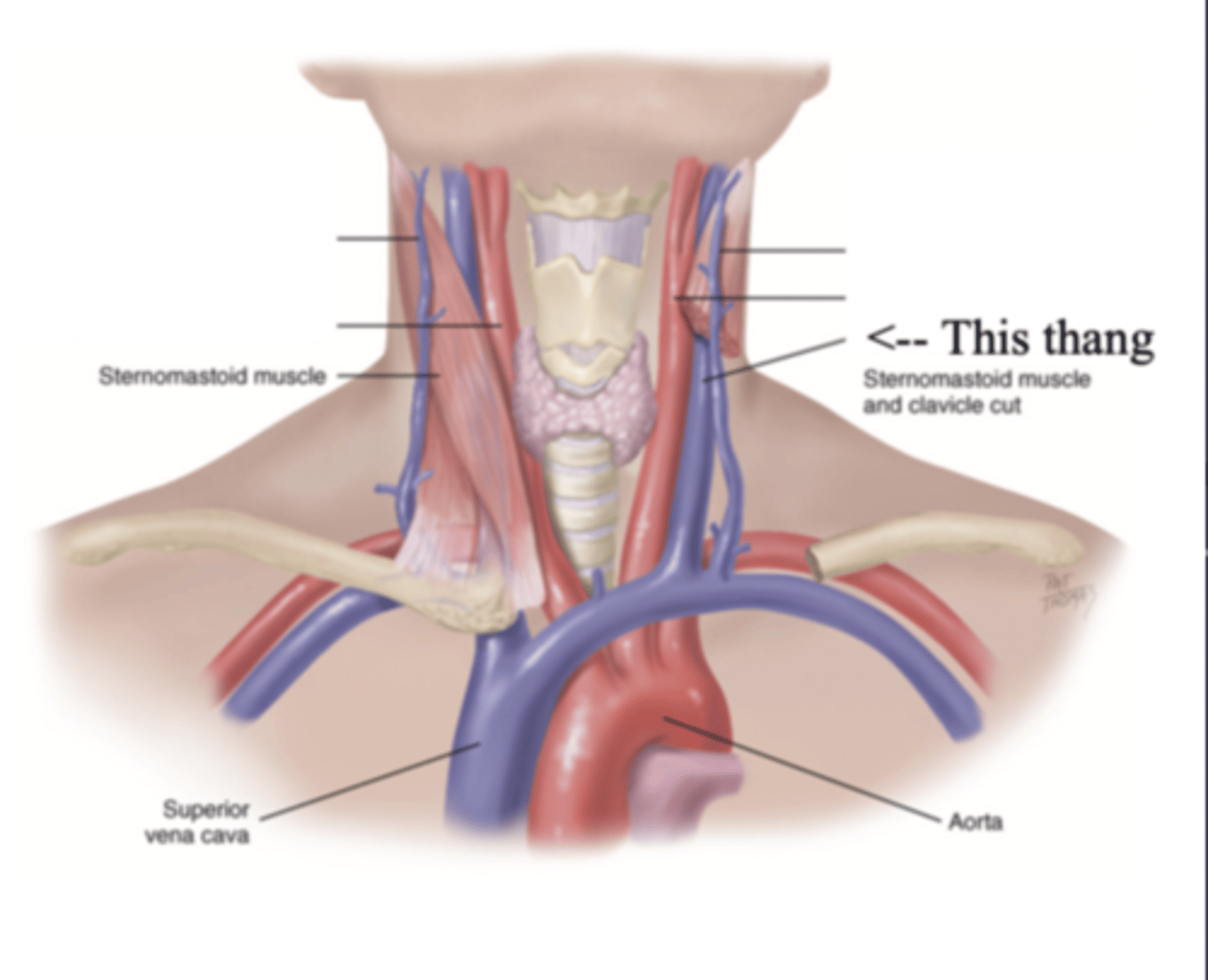 <p>The deeper jugular vein that lies medial to the sternocleidomastoid</p>