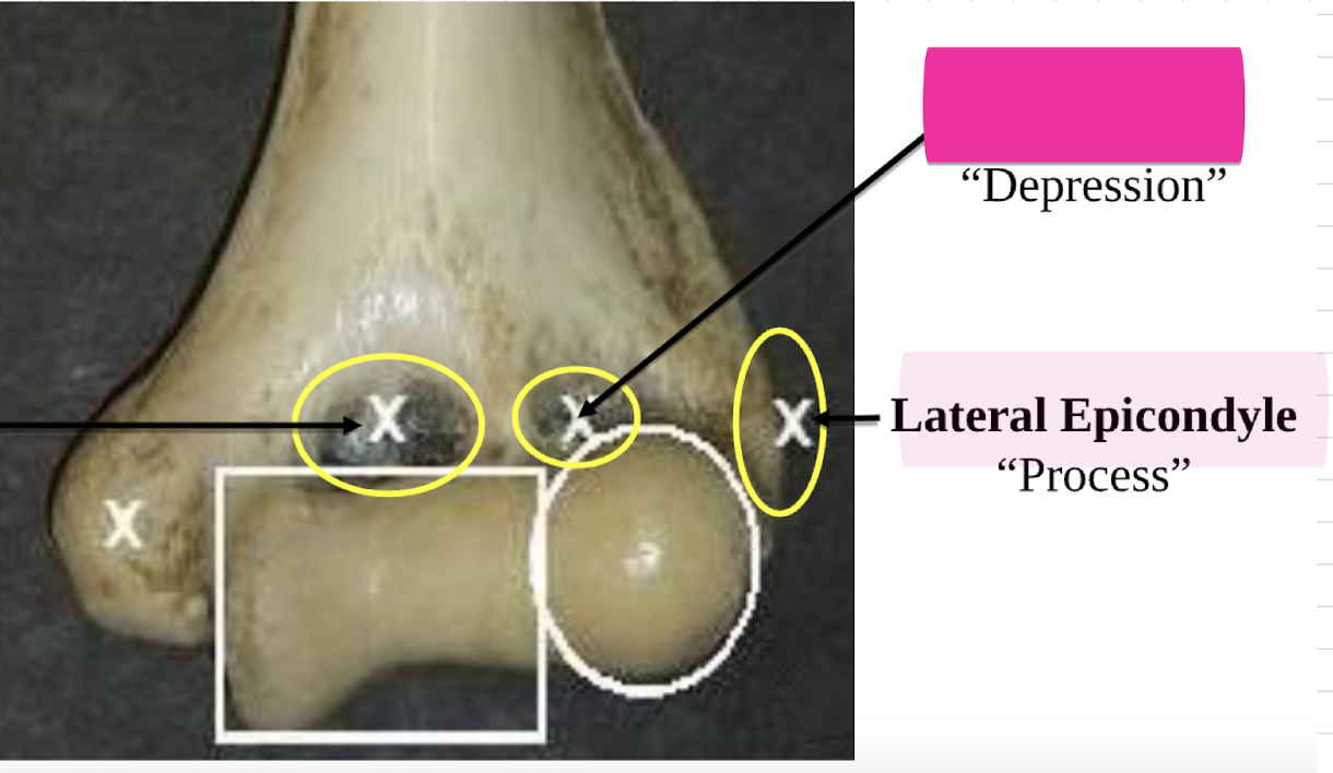 <p>Lateral Epicondyle </p>