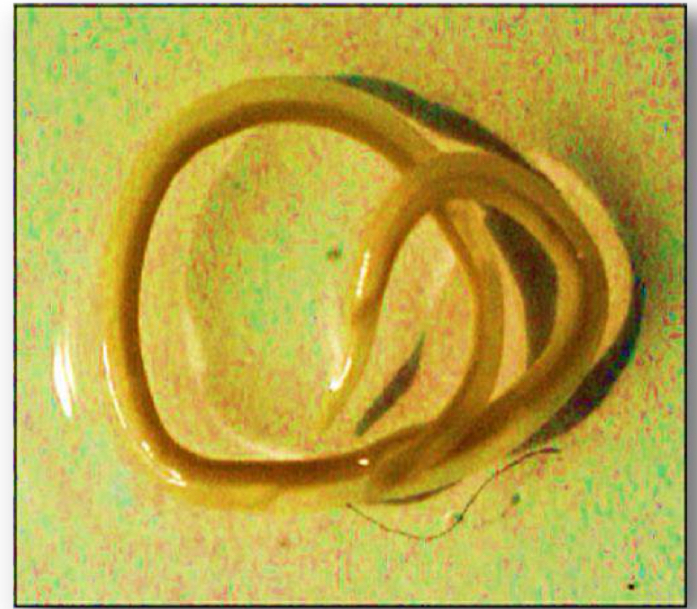 <p>Parasite under microscope</p>
