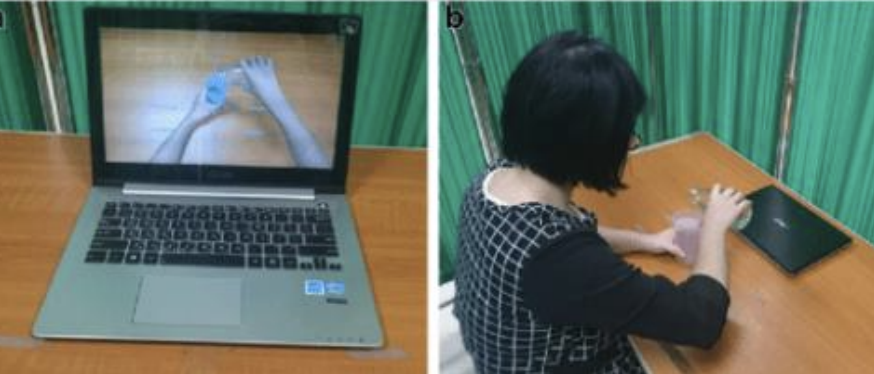 <ul><li><p>Action observation is an intervention in which <strong><u>a person observes a ”typical” person perform a functional task either by video or though live performance in the stroke population</u></strong></p></li><li><p>Usually, the <strong><u>person is asked to practice the task after AO</u></strong></p></li><li><p><strong><u>Candidate</u></strong>: </p><ul><li><p><strong><u>cognitively intact, </u></strong></p></li><li><p><strong><u>no motor requirements, </u></strong></p></li><li><p>however, <strong><u>some movement to perform task after AO</u></strong></p></li></ul></li></ul><p>image e.g.,&nbsp;</p><ul><li><p><strong><u>patient watches a video and tries to replicate it&nbsp;</u></strong></p></li></ul><p></p>