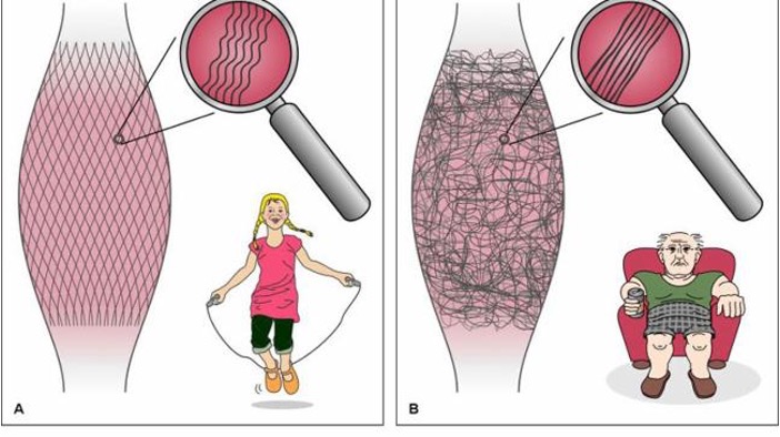 <p><span><span>= vliezen tussen of rond&nbsp;spieren, spiergroepen, botten, gewrichten en lichaamsholtes&nbsp;en deze samenhouden en bedekken</span></span></p><ul><li><p style="text-align: left;"><span><span>bevat collagene vezelsmyofasciale pijn</span></span></p></li><li><p style="text-align: left;"><span><span>geeft doorgang aan zenuwen en bloedvaten</span></span></p></li></ul><p><br><span><strong><span>Beweging zorgt er voor dat je jouw systeem van je _____ nat houd.</span></strong></span></p><ul><li><p style="text-align: left;"><span><span>Hyaluzonzuur zorgt er voor dat het water kan trekken.</span></span></p></li><li><p style="text-align: left;"><span><span>Bij ouderdom word de fasciae droger en wordt verknoopt en verkleefd, als je dan wil rekken zal je voelen dat je niet maximaal kan inspannen of ontspannen.</span></span></p></li></ul><p></p>
