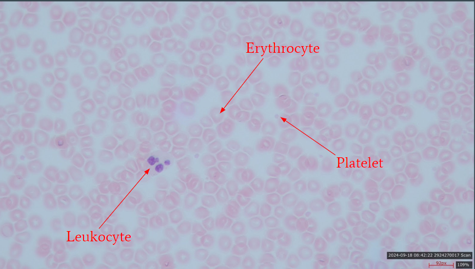 <ul><li><p>leukocyte</p></li><li><p>erythrocyte</p></li><li><p>platelet </p></li></ul><p></p>