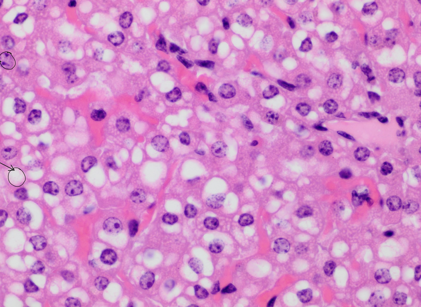 <p>what are the purple spots?</p>