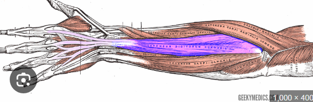 term image