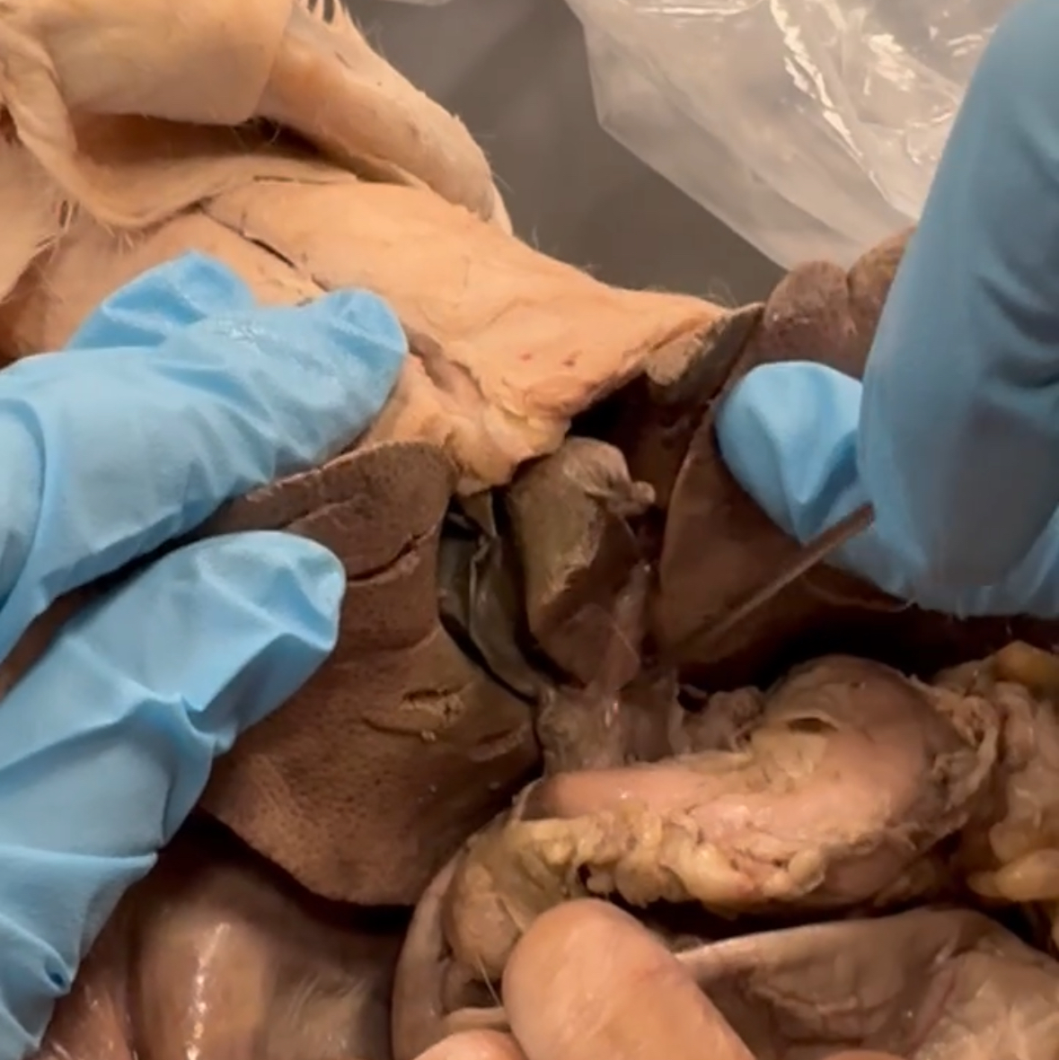 <p>connects from liver to cystic and common bile</p>